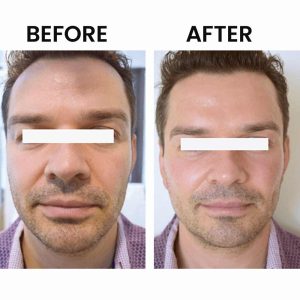 Unveiling Your Best Skin: A Guide to our more popular Laser Treatments