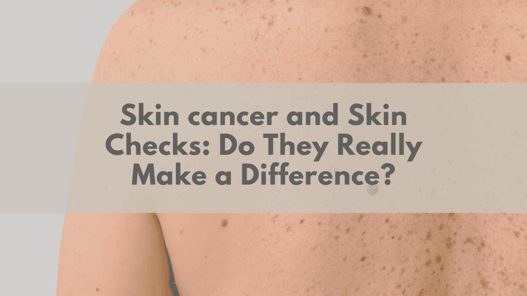 Skin cancer and Skin Checks: Do They Really Make a Difference?