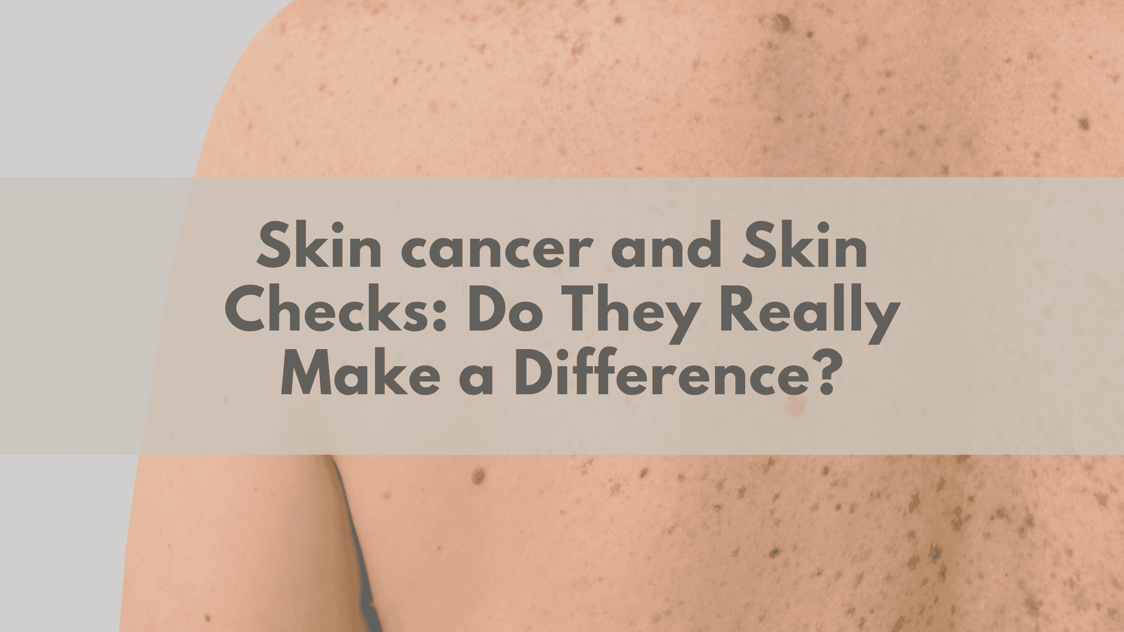 Skin cancer and Skin Checks: Do They Really Make a Difference?