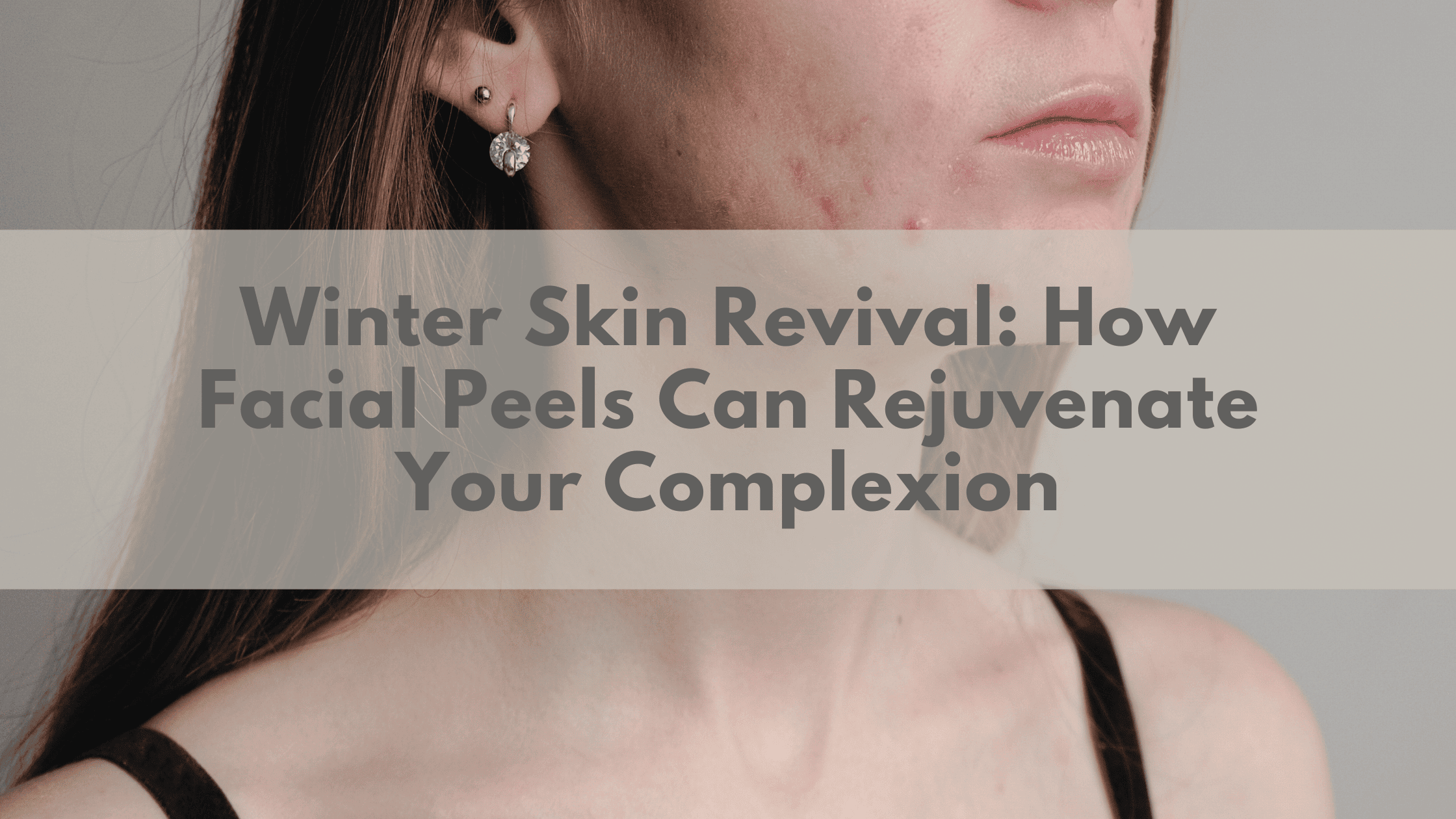 Winter Skin Revival: How Facial Peels Can Rejuvenate Your Complexion | Plexus South Yarra